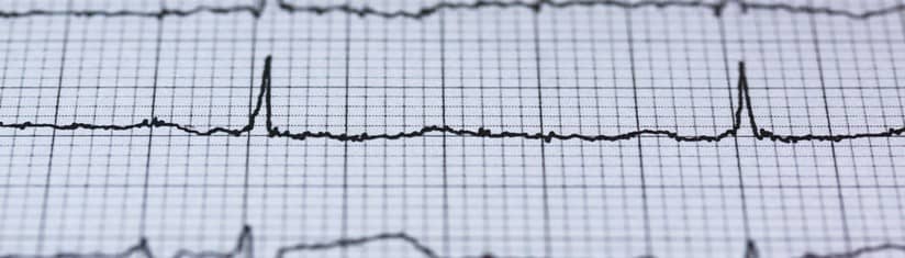 Curcuma bienfaits Maladie cardiaque UnAourDeSoifr